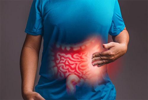Homeopathy Treatment for Irritable BowelTreatment In Kurnool
