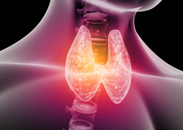 Homeopathy Treatment for Hypothyroid In Kurnool