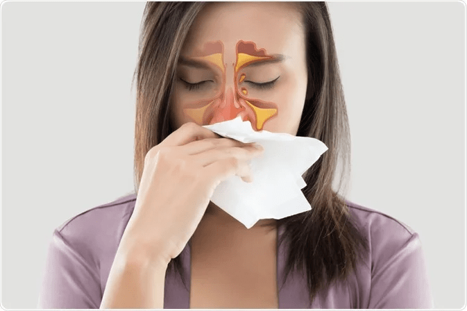 Homeopathy Treatment for Allergic Rhinitis In Kurnool