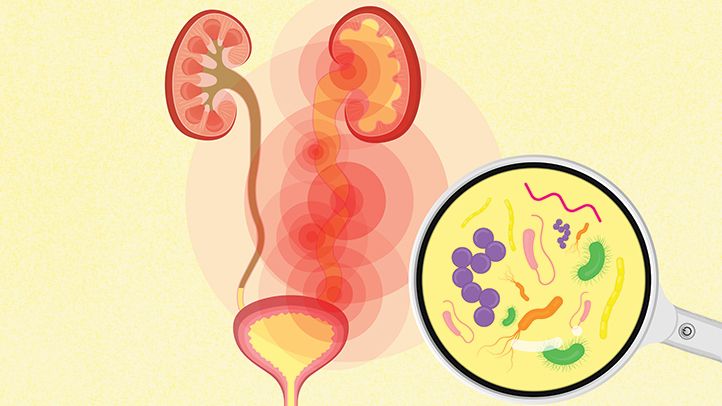 Homeopathy Treatment for Urinary Tract Infection in Children In Kurnool